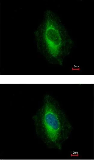 Immunocytochemistry/ Immunofluorescence - Anti-EPLIN antibody (AB154530)