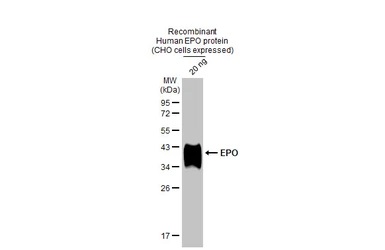 Western blot - Anti-EPO antibody [HL1794] (ab308197), expandable thumbnail