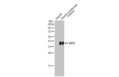 Western blot - Anti-EPO antibody [HL1794] (AB308197), expandable thumbnail