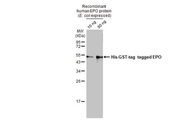 Western blot - Anti-EPO antibody [HL1794] (ab308197), expandable thumbnail