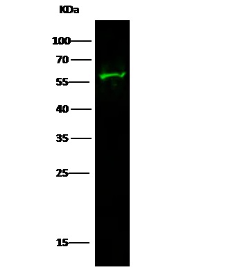 Western blot - Anti-EPO-R antibody [016] (AB275686), expandable thumbnail