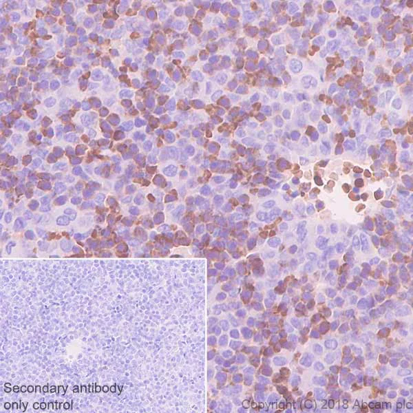 Immunohistochemistry (Formalin/PFA-fixed paraffin-embedded sections) - Anti-EPO-R antibody [EPR22366-40] - BSA and Azide free (AB245127)