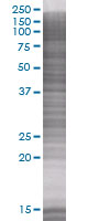 EPO-R overexpression 293T lysate (whole cell)