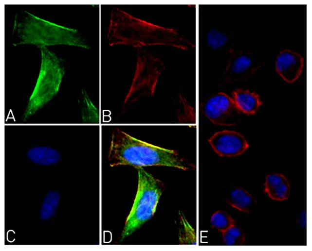 Immunocytochemistry/ Immunofluorescence - Anti-EPO-R (phospho Y454 + Y456) antibody [RP23040088] (AB308034)