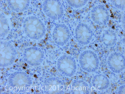 Immunohistochemistry (Formalin/PFA-fixed paraffin-embedded sections) - Anti-Epoxide hydrolase antibody [15B2AD9] (AB110307)