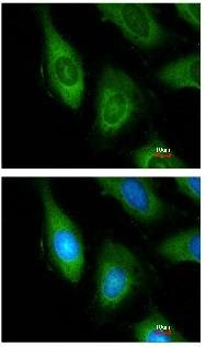 Immunocytochemistry/ Immunofluorescence - Anti-Epoxide hydrolase antibody (AB96695), expandable thumbnail
