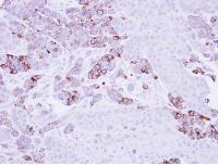 Immunohistochemistry (Formalin/PFA-fixed paraffin-embedded sections) - Anti-Epoxide hydrolase antibody (AB96695), expandable thumbnail