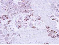 Immunohistochemistry (Formalin/PFA-fixed paraffin-embedded sections) - Anti-Epoxide hydrolase antibody (AB96695)