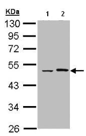 Western blot - Anti-Epoxide hydrolase antibody (AB96695), expandable thumbnail