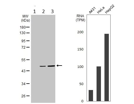 Western blot - Anti-Epoxide hydrolase antibody (AB96695)