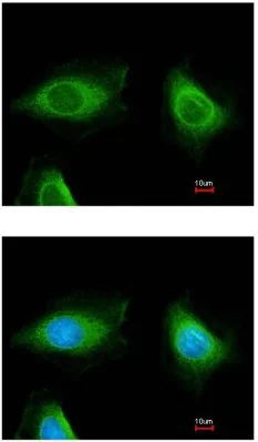 Immunocytochemistry/ Immunofluorescence - Anti-Epoxide hydrolase antibody (AB96774)