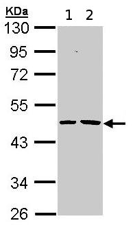 Western blot - Anti-Epoxide hydrolase antibody (AB96774), expandable thumbnail