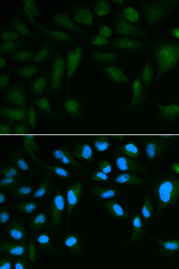 Immunocytochemistry/ Immunofluorescence - Anti-EPPIN antibody (AB185699), expandable thumbnail