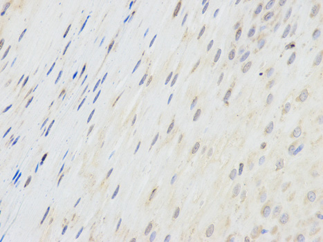 Immunohistochemistry (Formalin/PFA-fixed paraffin-embedded sections) - Anti-EPPIN antibody (AB185699), expandable thumbnail
