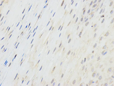 Immunohistochemistry (Formalin/PFA-fixed paraffin-embedded sections) - Anti-EPPIN antibody (AB185699)