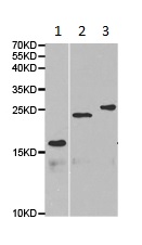 Western blot - Anti-EPPIN antibody (AB185699), expandable thumbnail