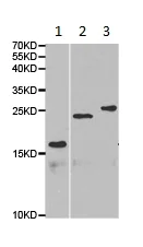 Western blot - Anti-EPPIN antibody (AB185699)