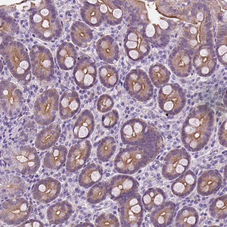Immunohistochemistry (Formalin/PFA-fixed paraffin-embedded sections) - Anti-EPPK1 antibody (AB247172)