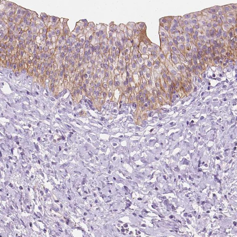Immunohistochemistry (Formalin/PFA-fixed paraffin-embedded sections) - Anti-EPPK1 antibody (AB247172)