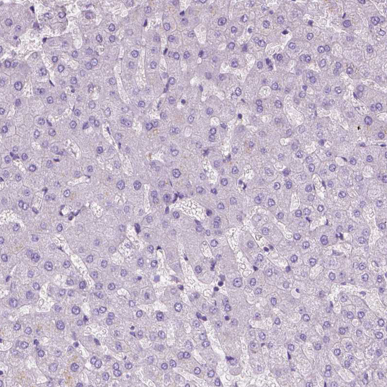 Immunohistochemistry (Formalin/PFA-fixed paraffin-embedded sections) - Anti-EPPK1 antibody (AB247172)