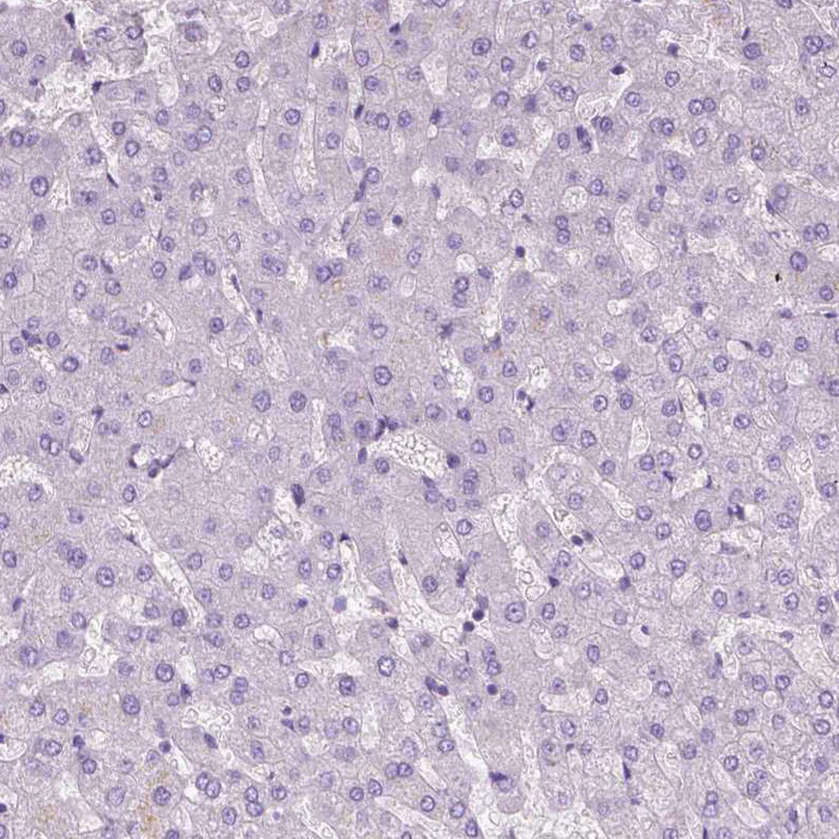 Immunohistochemistry (Formalin/PFA-fixed paraffin-embedded sections) - Anti-EPPK1 antibody (AB247172)