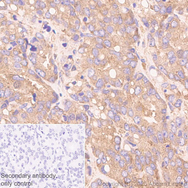 Immunohistochemistry (Formalin/PFA-fixed paraffin-embedded sections) - Anti-EPS15 antibody [EP9280] - BSA and Azide free (AB284823)