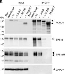 Western blot - Anti-EPS15R antibody [EP1146Y] (AB76004)
