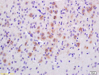 Immunohistochemistry (Formalin/PFA-fixed paraffin-embedded sections) - Anti-EPS8 antibody (AB203272)