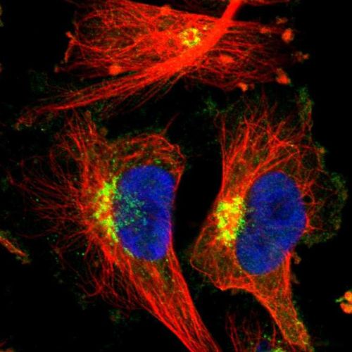 Immunocytochemistry/ Immunofluorescence - Anti-EPS8 antibody (AB244271), expandable thumbnail