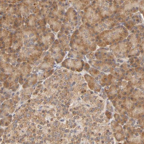 Immunohistochemistry (Formalin/PFA-fixed paraffin-embedded sections) - Anti-EPS8 antibody (AB244271), expandable thumbnail