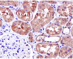 Immunohistochemistry (Formalin/PFA-fixed paraffin-embedded sections) - Anti-EPS8 antibody [EPR6112] (AB124882)
