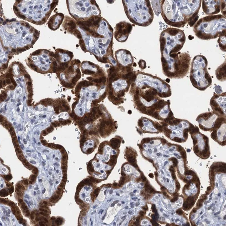 Immunohistochemistry (Formalin/PFA-fixed paraffin-embedded sections) - Anti-EPS8L1 antibody (AB272642)