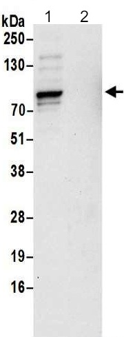 Immunoprecipitation - Anti-Epsin 1 antibody (AB192908)