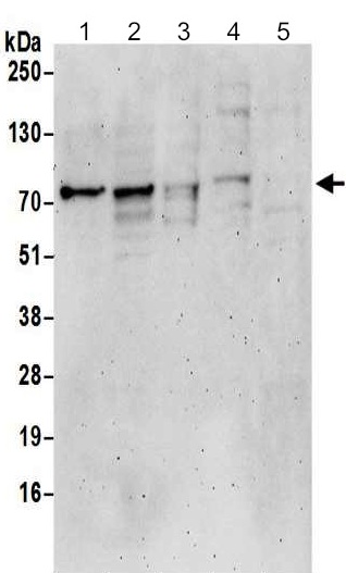 Western blot - Anti-Epsin 1 antibody (AB192908)