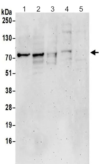 Western blot - Anti-Epsin 1 antibody (AB192908)