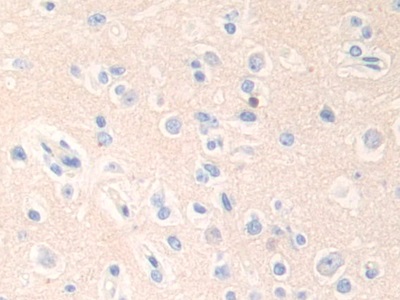 Immunohistochemistry (Formalin/PFA-fixed paraffin-embedded sections) - Anti-Epsin 1 antibody (AB232764)