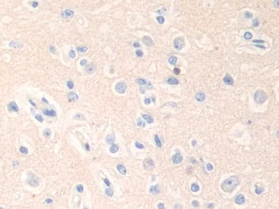 Immunohistochemistry (Formalin/PFA-fixed paraffin-embedded sections) - Anti-Epsin 1 antibody (AB232764)