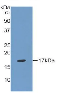 Western blot - Anti-Epsin 1 antibody (AB232764)