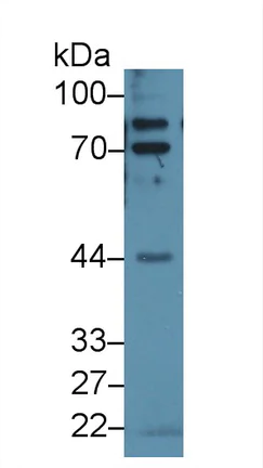 Western blot - Anti-Epsin 1 antibody (AB232764)