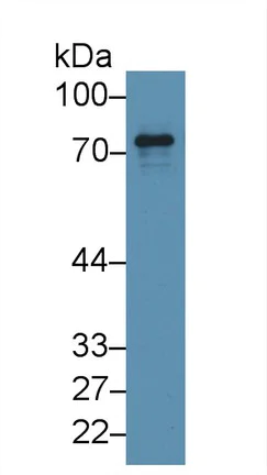 Western blot - Anti-Epsin 1 antibody (AB232764)