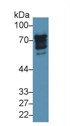 Western blot - Anti-Epsin 1 antibody (AB232764)