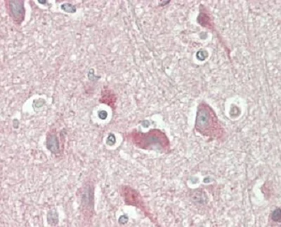 Immunohistochemistry (Formalin/PFA-fixed paraffin-embedded sections) - Anti-Epsin 2 antibody (AB230546)
