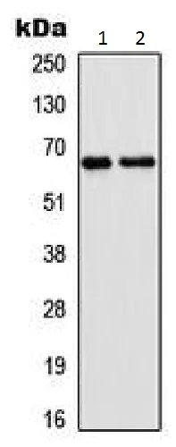 Western blot - Anti-Epsin 2 antibody (AB230546)