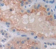 Immunohistochemistry (Formalin/PFA-fixed paraffin-embedded sections) - Anti-EPSTI1 antibody (AB233036), expandable thumbnail