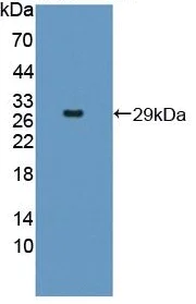 Western blot - Anti-EPSTI1 antibody (AB233036)