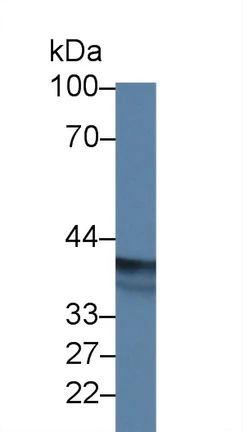 Western blot - Anti-EPSTI1 antibody (AB233036)