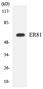 Western blot - Anti-ER81/ETV1 antibody (AB136121)