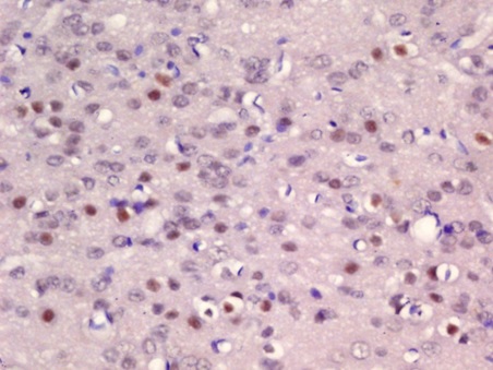 Immunohistochemistry (Formalin/PFA-fixed paraffin-embedded sections) - Anti-ER81/ETV1 antibody (AB216594)