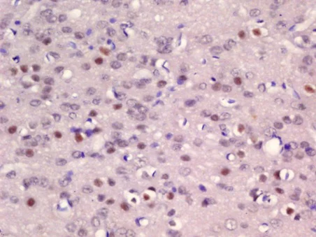 Immunohistochemistry (Formalin/PFA-fixed paraffin-embedded sections) - Anti-ER81/ETV1 antibody (AB216594)
