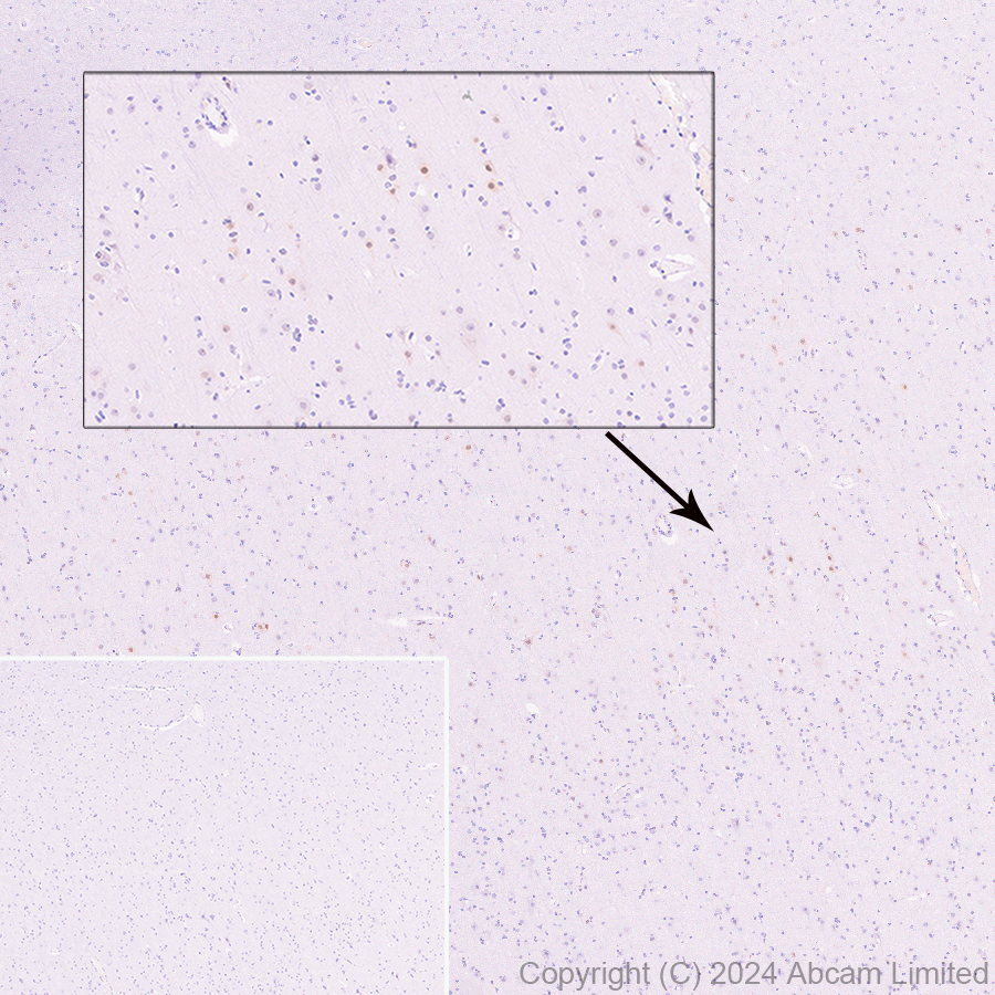 Immunohistochemistry (Formalin/PFA-fixed paraffin-embedded sections) - Anti-ER81/ETV1 antibody [DZR-1-29] (ab322139), expandable thumbnail